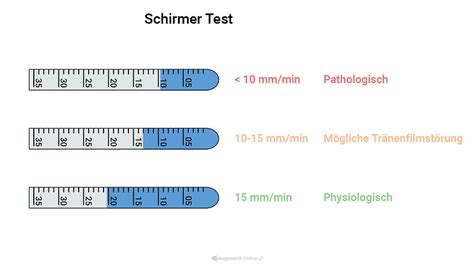 schirmer's test normal value